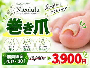 ニコルル 大阪天満店(Nicolulu)の写真/【仕上がりが目立たない！】マニキュアも楽しめる特許技術の＜巻き爪補正＞ホームケア方法もお伝えします☆