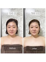 バイラキ(by laki)/