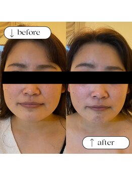 トータルビューティーサロンリア(Li'a)/ビフォー＆アフター