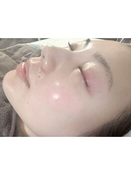 お肌をきれいにしたい