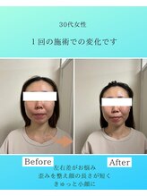 マハロ 海老名店(Mahalo)/小顔矯正　30代女性