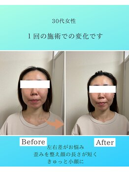 マハロ 海老名店(Mahalo)/小顔矯正　30代女性