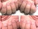 エンチューン(en.tune)の写真/爪が割れる、深爪や噛み癖、むしり癖…etc あらゆる爪の悩みを解消するための最適なサロンがここに★