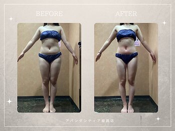 アバンダンティア 姫路店/脂肪冷却