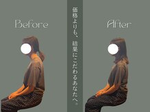 スクエア整体院(Square整体院)/巻き肩改善　Before→After