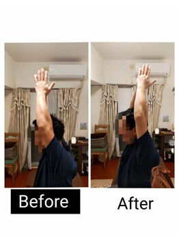 アース エンジェル整体院/ビフォアフ　肩こり　ストレッチ