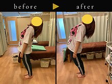 杉本接骨鍼灸院/背骨から全身がユルユル整体