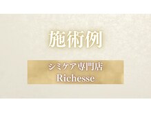 リシェス(Richesse)/施術例