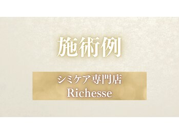 リシェス(Richesse)/施術例