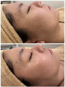 ビーカーブス 三鷹(B.curves)/before・after