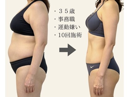 ニュートラル 池袋店(NEUTRAL)の写真