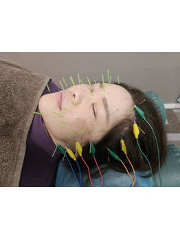 ホウレイ線・たるみ改善！予防ケア