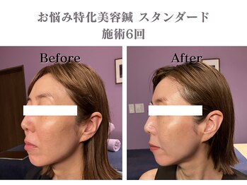 シー バイ カリスタ 新宿南口店(C by CALISTA)/赤みが引き、肌のツヤ感がUP