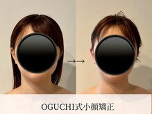 アロラヴィ(AroRavi)/ブライダルエステ