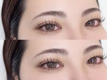 ソア(soa.)/LED上下(Haruka施術)