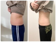 ゆうきや整体院/ぽっこりお腹解消！整体+キャビ