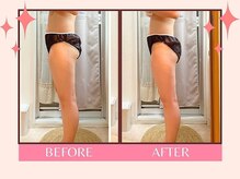 ヨサパーク 美キレイ 仙台店(YOSAPARK 美 Kirei)/短期集中！ビフォーアフター