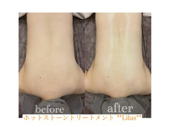 リラ(Lilas)/ホットストーンでゆるめて流す