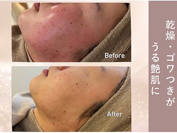 エヴァル(ewalu)/ー 3ヶ月の変化 ー