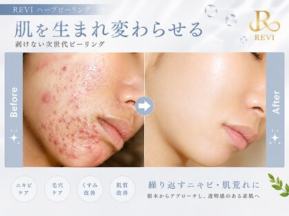 ホワイトアクア 浜松店(WHITE AQUA)の写真