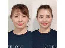 マナレア 湘南(Manalea)の雰囲気(【小顔矯正】面長・エラ・たるみ・左右差など大人のお顔悩みに◎)