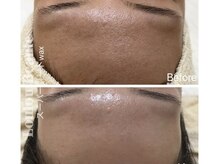 ルルボーテ(Loulou Beaute)/waxxxx 