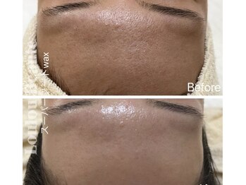 ルルボーテ(Loulou Beaute)/waxxxx