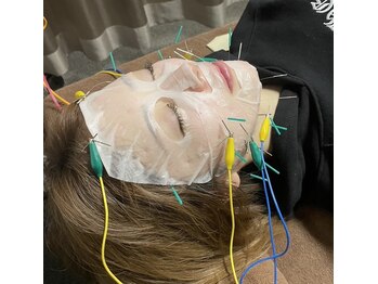 きらめき鍼灸治療院/最高の小顔に♪