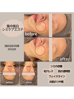 モーイエンチャーム(mooi en charme)/集中美白×小顔エステ