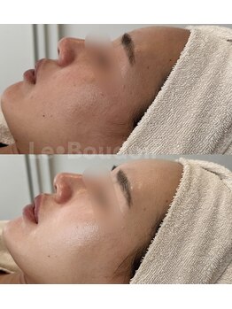 ルブドワール(Le Boudoir)/ララピール before →after