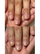 マイントゥ ネイル(mine too nail)/薄い爪、形が不恰好な爪、深爪も