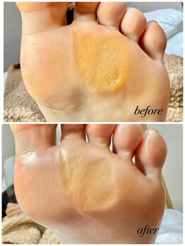 ラヴィ(La vie)/夏前にケア