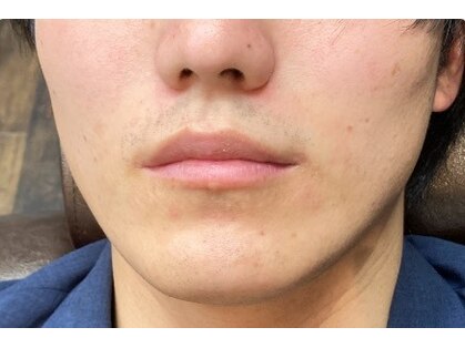 パンダの脱毛サロンの写真