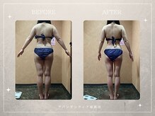 アバンダンティア 姫路店/脂肪冷却