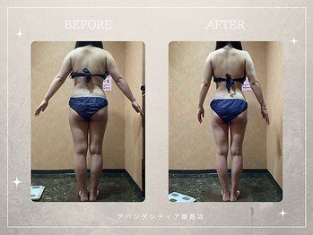 アバンダンティア 姫路店/脂肪冷却