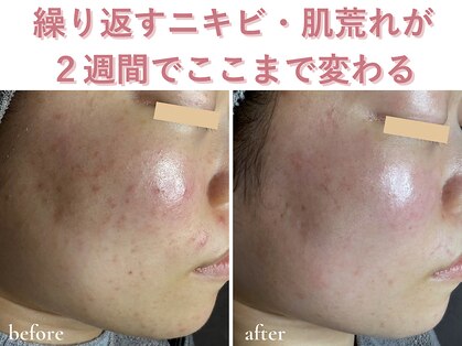 エアル(earu.)の写真