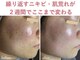 エアル(earu.)の写真