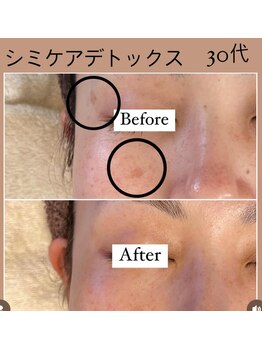 リラクゼーションルーム チュラ(Relaxation Room CERAH)/