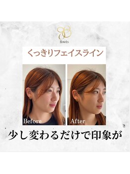 ルーツ(R∞ts)/くっきりフェイスライン