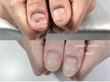 エスネイル(S-nail)