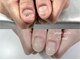 エスネイル(S-nail)の写真