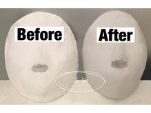 美極 トータルビューティー(美極 TOTAL BEAUTY)/恵比寿/小顔コルギ/エステ/