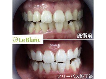 ルブラン 奈良店(Le Blanc)/当店一番人気！！
