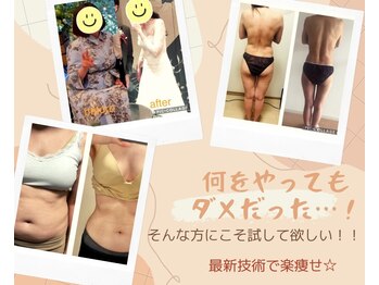 ヨサパーク ハーブ ラキ 鳴海店(YOSA PARK herb *Laki)/リバウンドの歴史に終止符を！