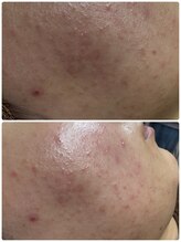 アレーズファイブフォー(A’LAISE54)/