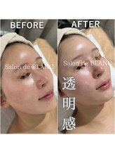 サロン ド ブラン アオヤマ(Salon de BLANC AOYAMA)/クリスティーナイラストリアス