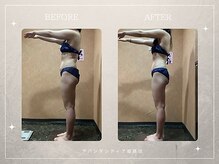 アバンダンティア 姫路店/脂肪冷却