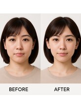 ビテ(Bite)/20代　会社員