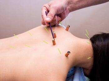 一丁目治療院/鍼灸