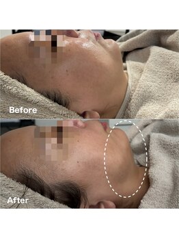 アンド(and...)/小顔・たるみケア◎レモンボトル